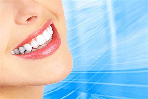 bright now teeth whitening|Teeth Whitening at Bright Now! Dental